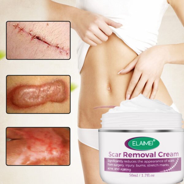 Skin Rebound Scarless Cream Scar Removal Cream Face Cream For Face Acne Scar Stretch Marks Skin Repair Face Cream - Image 2