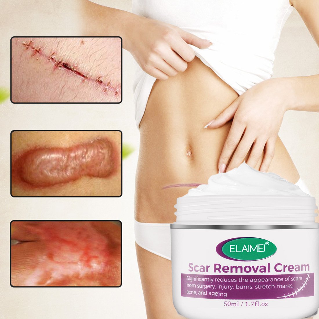 Skin Rebound Scarless Cream Scar Removal Cream Face Cream For Face Acne Scar Stretch Marks Skin Repair Face Cream - Image 2