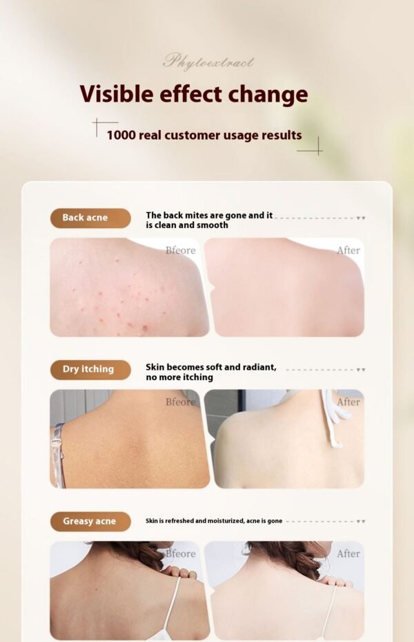 Shower Gel Back Acne Removing - Image 9