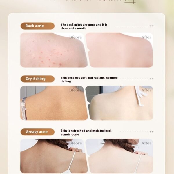 Shower Gel Back Acne Removing - Image 2